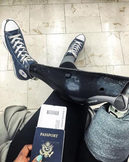 Девушке с ампутированной ногой оставалось жить всего 3 недели, но она победила болезнь и стала модным блогером. 08