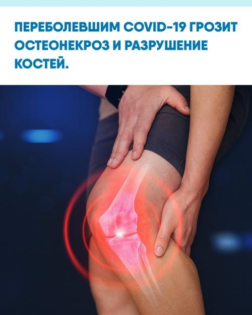 Учёные выяснили, что коронавирус может провоцировать постковидный остеонекроз, при котором нарушается кровообращение и гибнет костная ткань.
