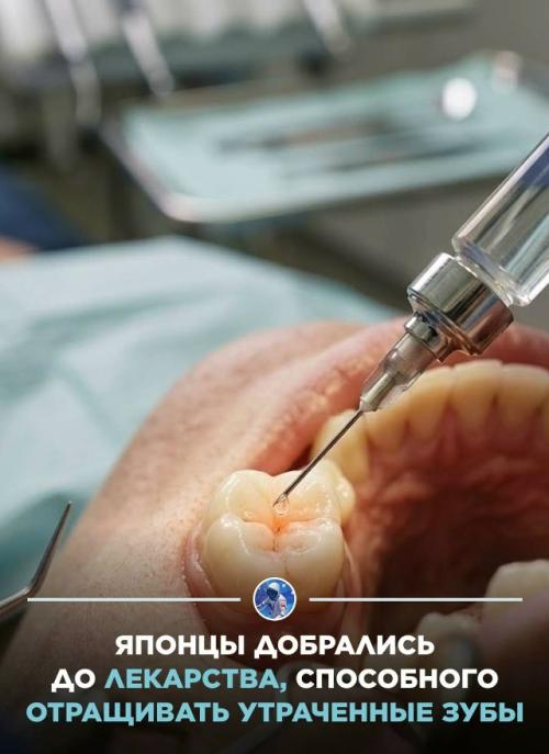 Trg035 работает не как протез или имплант: антитело блокирует белок Usag - 1, который способен тормозить развитие зубов. 01
