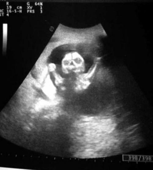 9 лет работаю узисткой в больнице.  