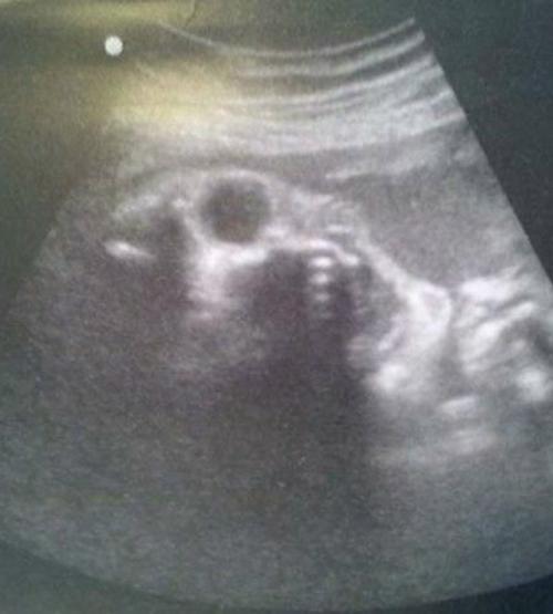 9 лет работаю узисткой в больнице. 01