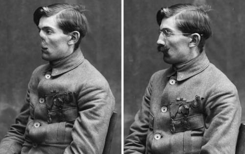 Анна коулман лэдд - одна из тех редких художников, чьё искусство стало буквальным спасением для людей. 03 Анна коулман лэдд - одна из тех редких художников, чьё искусство стало буквальным спасением для людей. 03