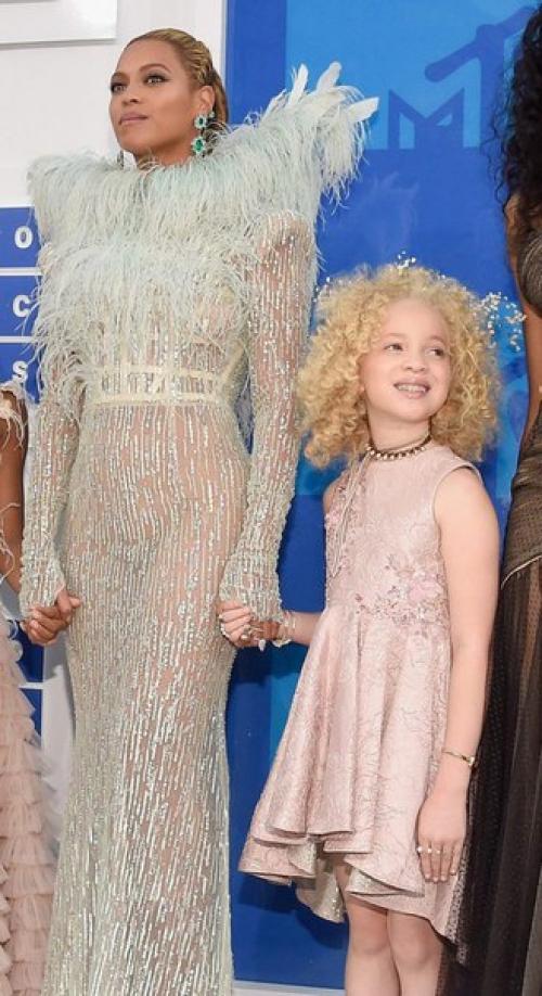 8-Летняя девочка - альбинос Ава Кларк - афроамериканка - альбинос. 04