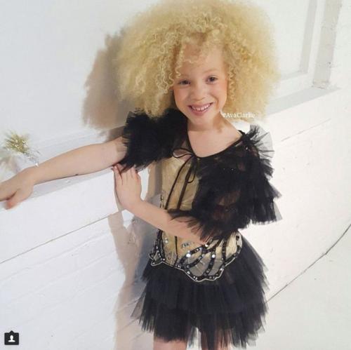 8-Летняя девочка - альбинос Ава Кларк - афроамериканка - альбинос. 01