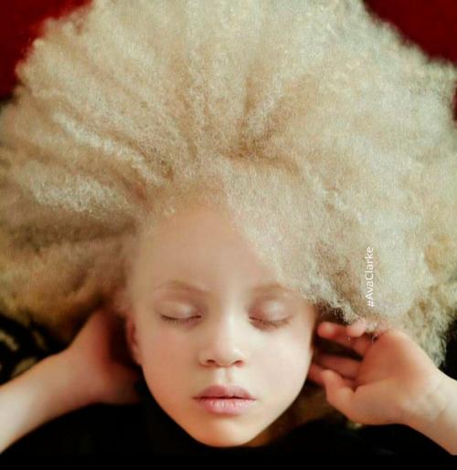 8-Летняя девочка - альбинос Ава Кларк - афроамериканка - альбинос.