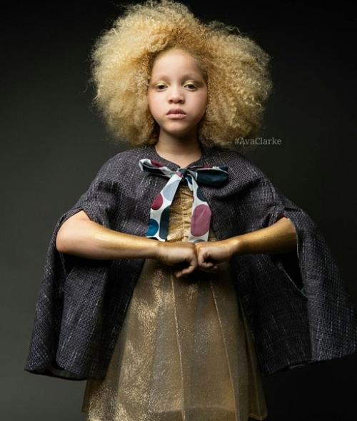 8-Летняя девочка - альбинос Ава Кларк - афроамериканка - альбинос. 02