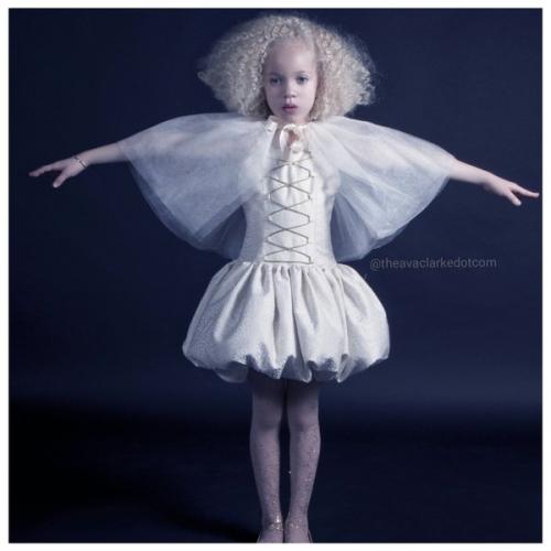 8-Летняя девочка - альбинос Ава Кларк - афроамериканка - альбинос. 06