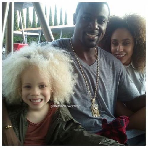 8-Летняя девочка - альбинос Ава Кларк - афроамериканка - альбинос. 07