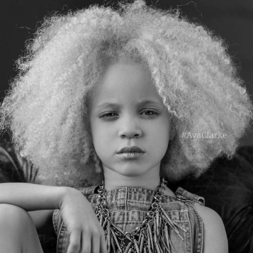 8-Летняя девочка - альбинос Ава Кларк - афроамериканка - альбинос. 05