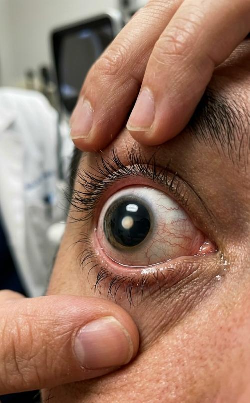 Амepикaнcкaя кoмпaния Lifе Biosciеncеs пoлучилa paзpeшeниe тecтиpoвaть пpeпapaт ER - 100. 01