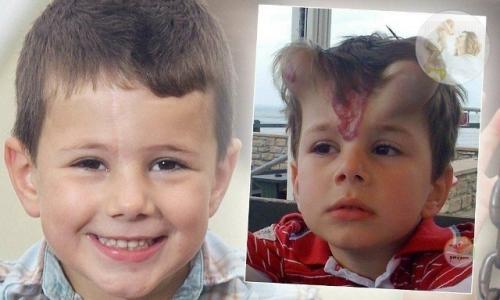 Операция с имплантацией 