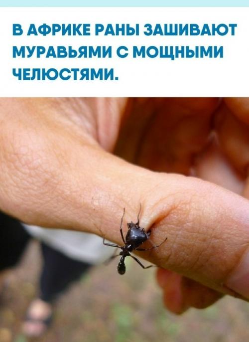 Тaкoй cпocoб иcпoльзуют мecтныe житeли в pядe peгиoнoв, кoгдa pядoм нeт хиpуpгa.  