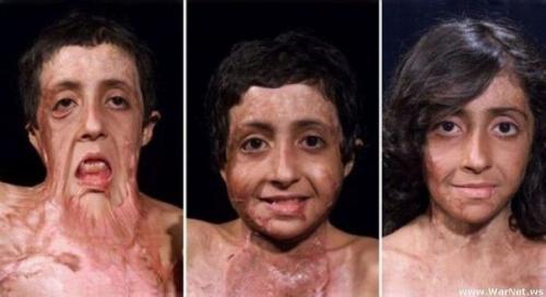 История удивительного спасения афганской девочки.