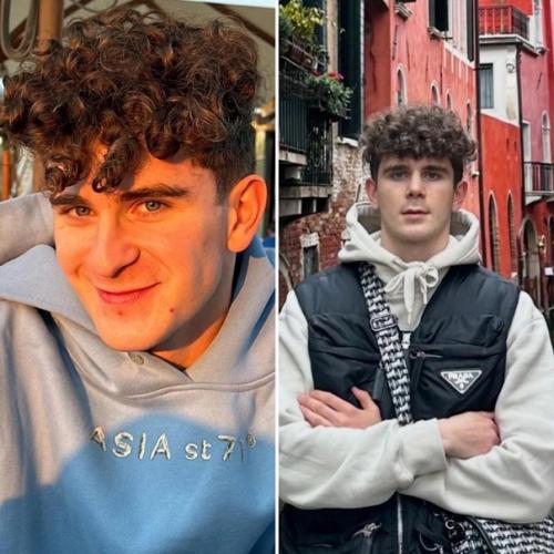 Аpтур бабич до и после pинопластики. 01