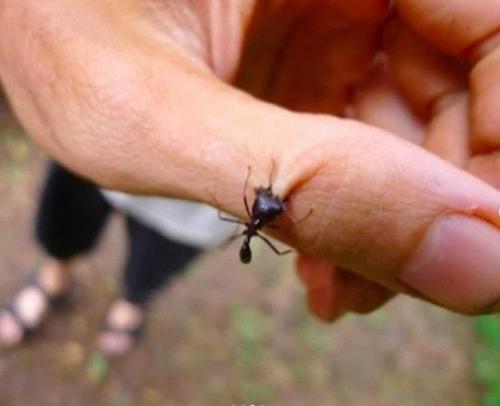 Таким образом, если рядом нет хирурга - зашей рану … муравьем. Таким образом, если рядом нет хирурга - зашей рану … муравьем.