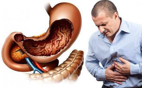 Желудочно-кишечный тракт имеет свою нервную систему, которая значительным o6 разом определяет эмоции человека.