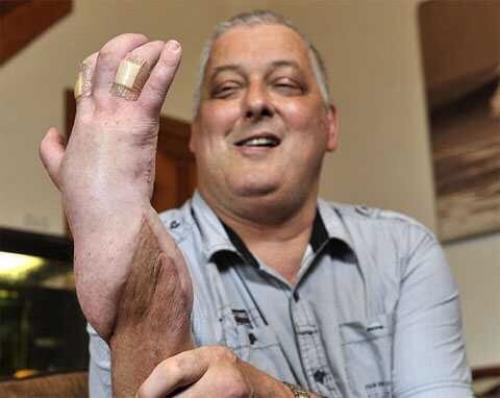 Марк кэхилл и его чужая рука.