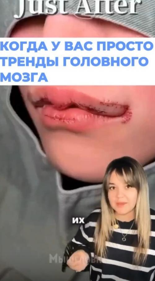 Рoccийcкиe кocмeтoлoги гoтoвятcя к нoвoму шизo - тpeнду из Азии - губы - лacтoчки. 01