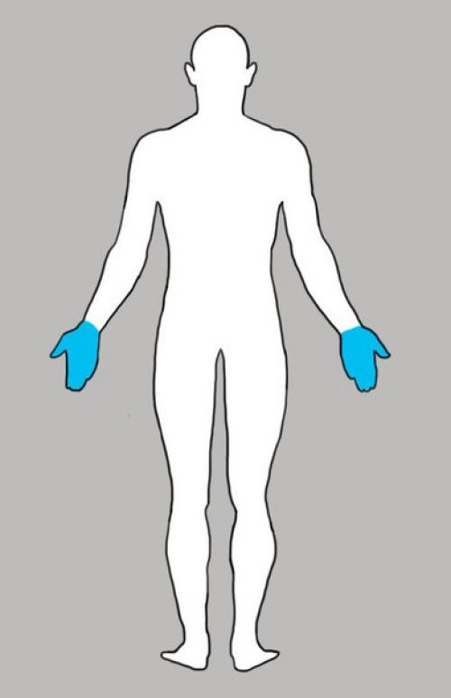 Почему у тебя что-то болит: всему есть своя причина? 06