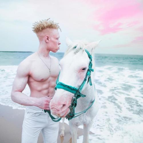 23-Летний лео джона из Лондона - альбинос. 04