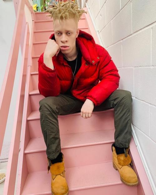 23-Летний лео джона из Лондона - альбинос. 05