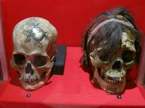 На фото - череп инка с золотой пластиной - имплантом, найденный в перу.  