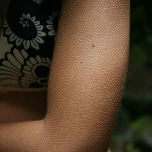 Когда говорят: у Меня Побежалимурашки по коже, человека можно поздравить. 02