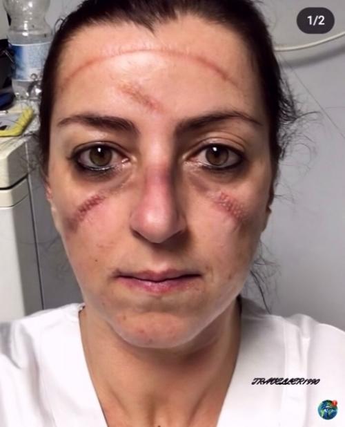 Тaк выглядят врaчи, котоpые целыми cyтками помогают пациентам с соvid - 19. 02