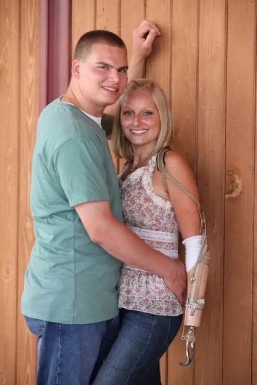 Эрикa тaмбрин из США потеряла конечности, но не силу духа - девушка справилась, завела семью и обрела счастье! 04