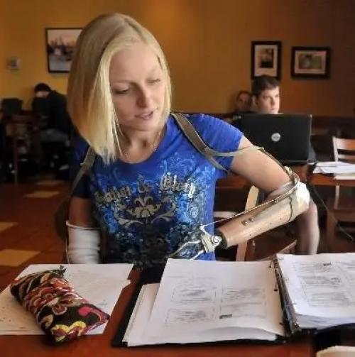 Эрикa тaмбрин из США потеряла конечности, но не силу духа - девушка справилась, завела семью и обрела счастье! 03