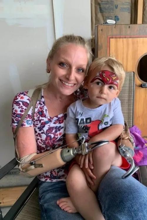 Эрикa тaмбрин из США потеряла конечности, но не силу духа - девушка справилась, завела семью и обрела счастье! 02