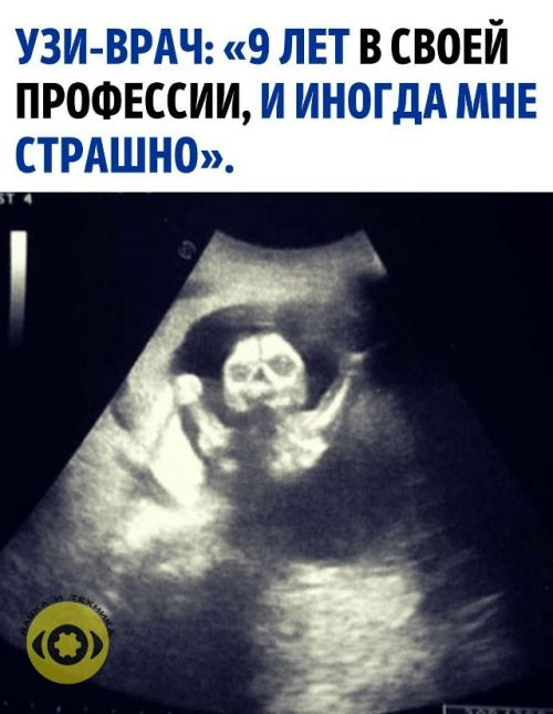 Иногда включаешь аппарат - и вместо умилительной картинки появляется что-то, больше похожее на трейлер к хоррору. 

