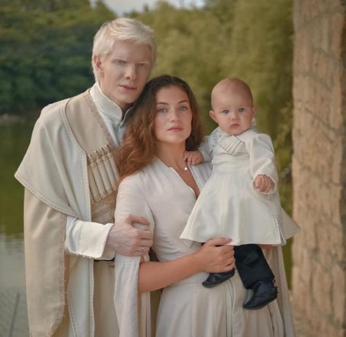 Альбинос из Грузии, бера иванишвили. 02