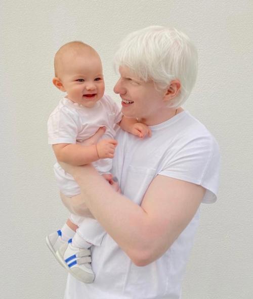 Альбинос из Грузии, бера иванишвили. 04