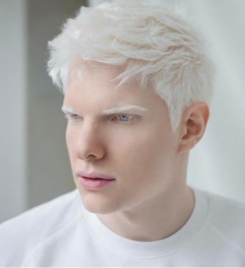 Альбинос из Грузии, бера иванишвили. 03