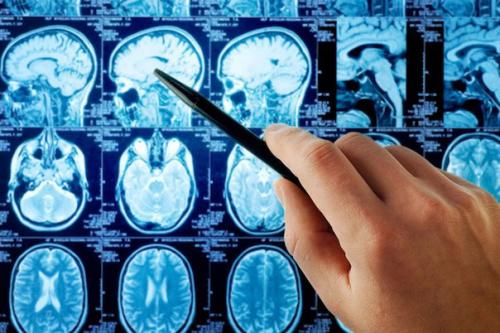 Баги человеческой психики.