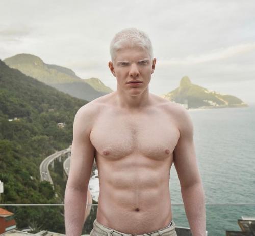 Альбинос из грузии. 08