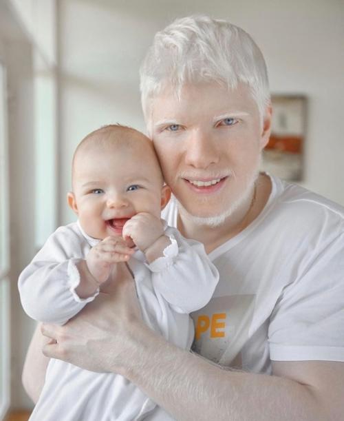 Альбинос из грузии. 02