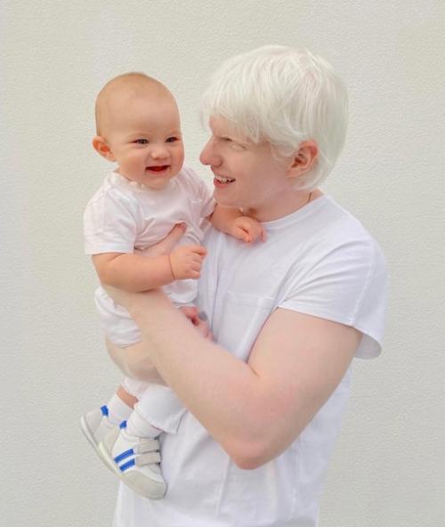 Альбинос из грузии. 03