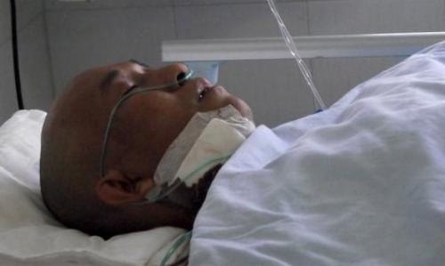 4 года с ножом в черепе. 01