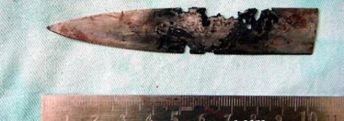 4 года с ножом в черепе. 02