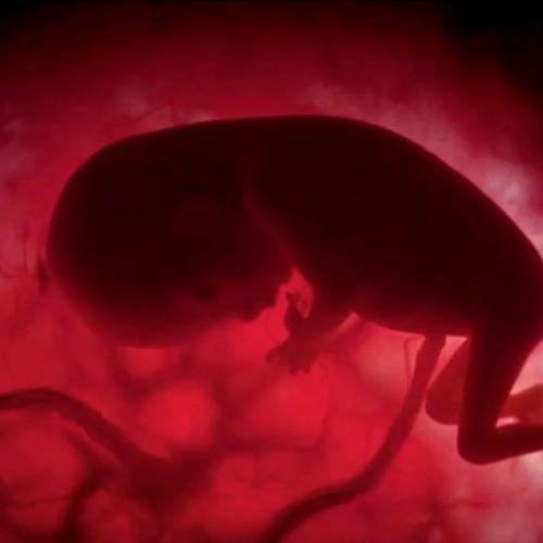 Почему ребёнок в утробе не испражняется до рождения? 01