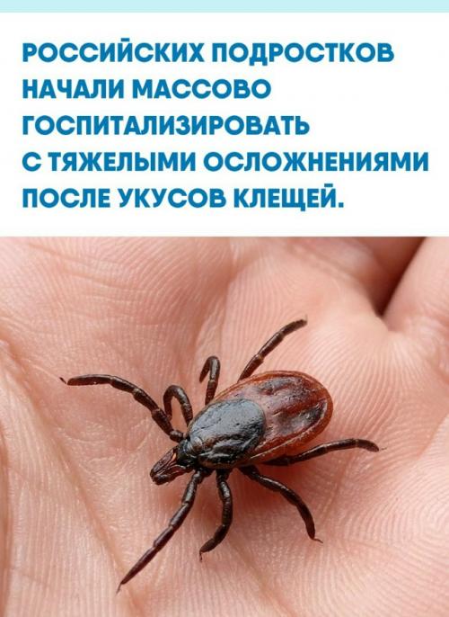 В Томске 16-летний парень после заражения болезнью лайма попал в реанимацию с диагнозом менингоэнцефалит.  