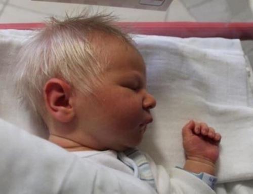 Бенс, или как его прозвали сотрудники больницы, Очаровательный Принц родился в Венгрии. 02