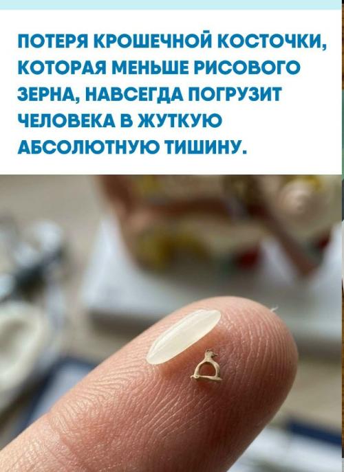 Крошечное стремечко размером всего три миллиметра работает как механический поршень, ежедневно принимающий на себя миллионы звуковых вибраций.  