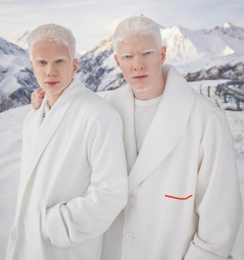 Бера иванишвили - сын миллиардера - грузин - альбинос. 09