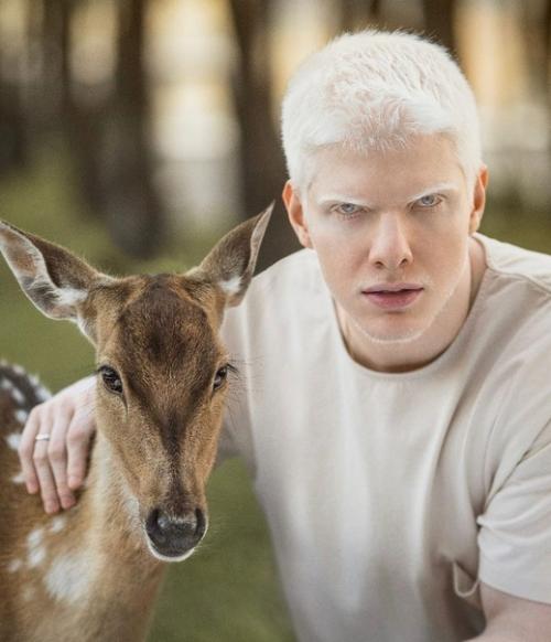 Бера иванишвили - сын миллиардера - грузин - альбинос. 08