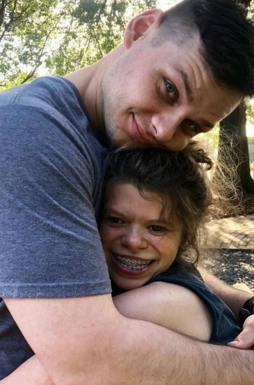 Александра берч из Великобритании страдает редким врожденным недугом - синдромом Уильямса. 02