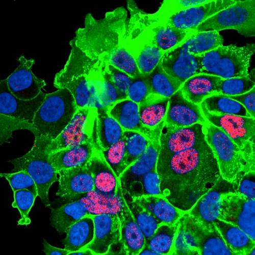 Специалисты разработали терапию, работающую по принципу Троянского Коня: особые клетки проникают внутрь опухоли и разрушают её изнутри. 02