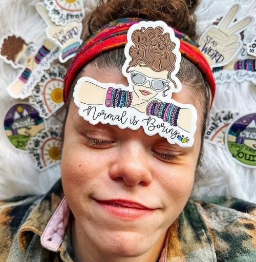 Александра берч из Великобритании страдает редким врожденным недугом - синдромом Уильямса. 01